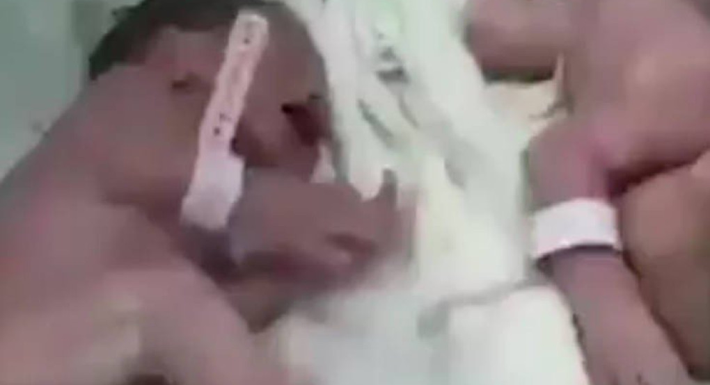 Δίδυμα γεννήθηκαν 20 λεπτά μετά τον σεισμό στην Αλβανία