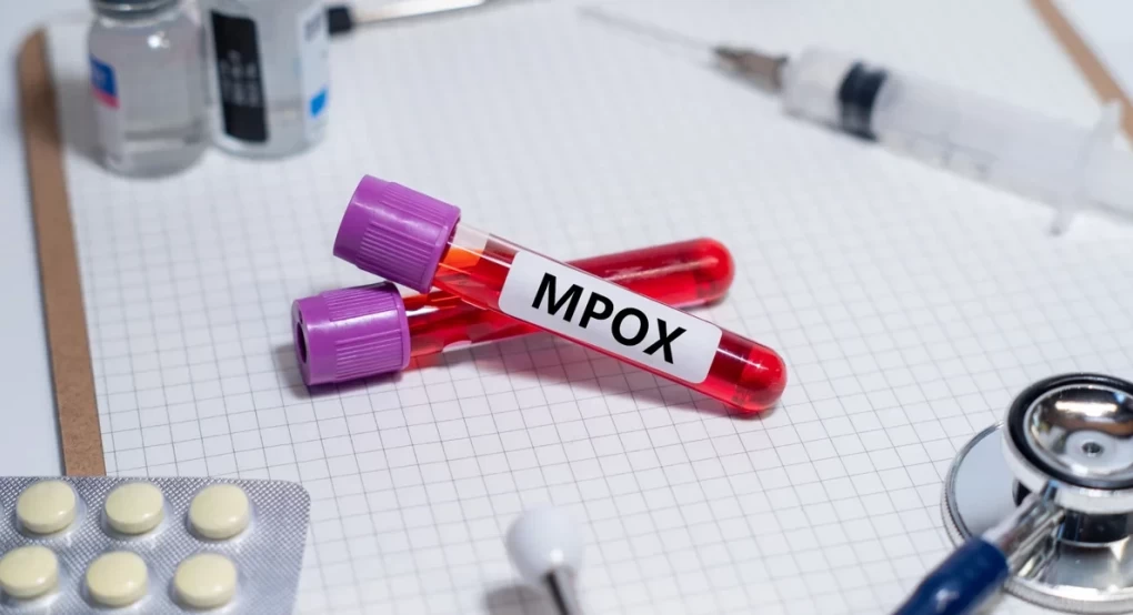 ΠΟΥ: Η mpox δεν είναι η νέα covid -Tι δήλωσε στέλεχος του Οργανισμού ΠΟΥ: Η mpox δεν είναι η νέα covid -Tι δήλωσε στέλεχος του Οργανισμού