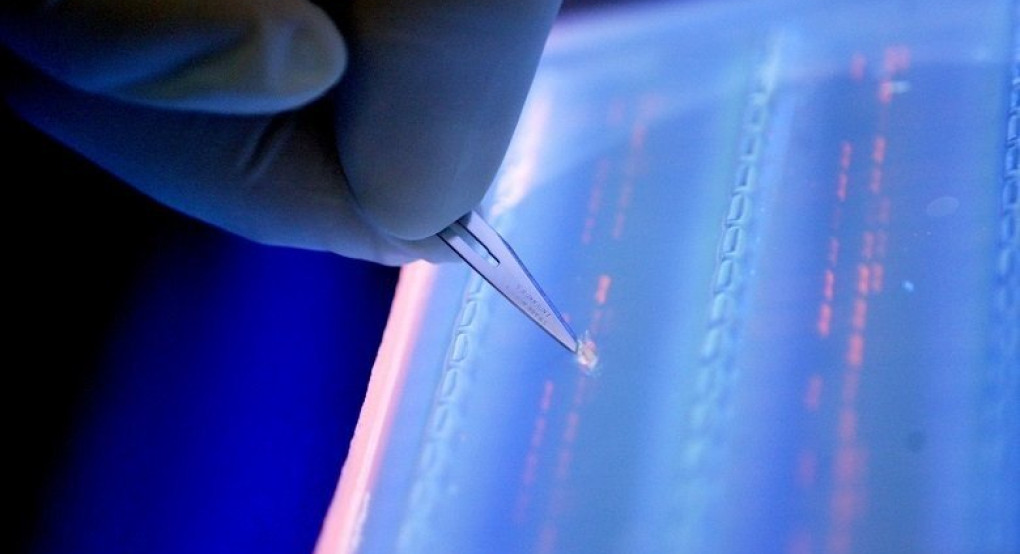 Σύστημα τεχνητής νοημοσύνης κάνει διάγνωση λευχαιμίας