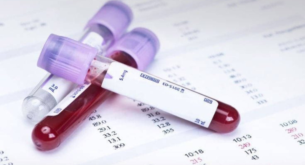 Τεστ αίματος θα δείχνει αν μια γυναίκα θα έχει την τελευταία περίοδό της στα επόμενα 1-2 χρόνια