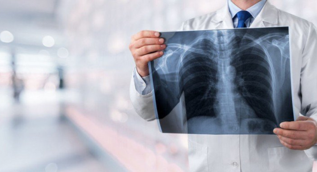 Economist: Κενά και καθυστερήσεις στην αντιμετώπιση του καρκίνου στην Ελλάδα -Τι δείχνει ευρωπαϊκή έρευνα 