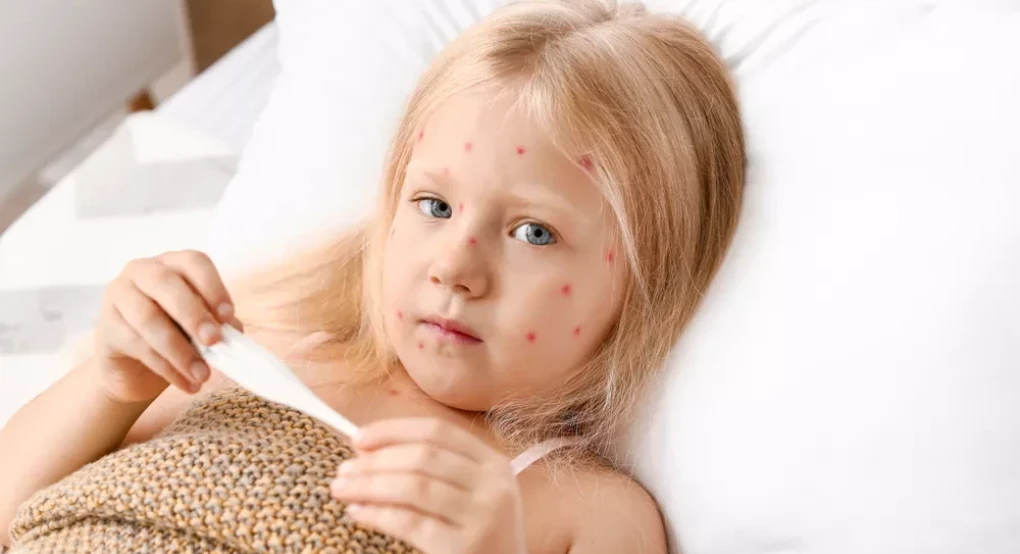 Ιλαρά και ερυθρά «επιστρέφουν» στην Ευρώπη – Η κατάσταση στην Ελλάδα