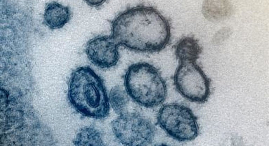 Κορονοϊός: Αυτή είναι η "κορόνα" του ιού - Εικόνες από μικροσκόπιο
