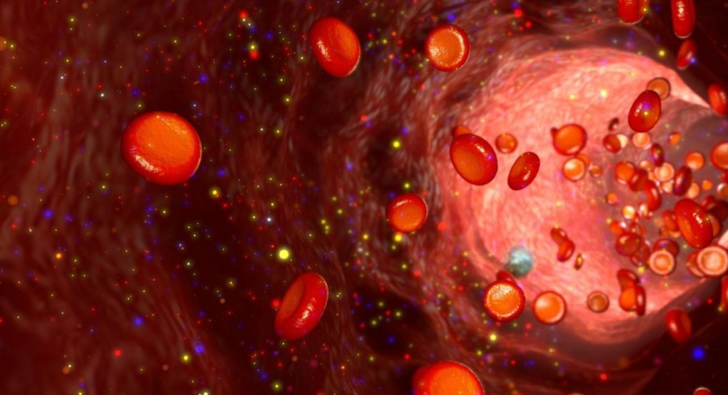 Οι Κουβανοί έφεραν στην Ιταλία το φάρμακο Alfa 2B το οποίο δοκιμάστηκε (επιτυχώς) κατά του κορωνοϊού στην Κίνα