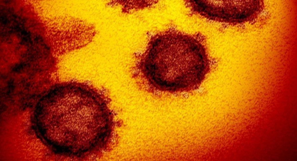 Ελένη Γιαμαρέλλου: «Η αύξηση ενός βαθμού της θερμοκρασίας μειώνει τη μεταδοτικότητα 