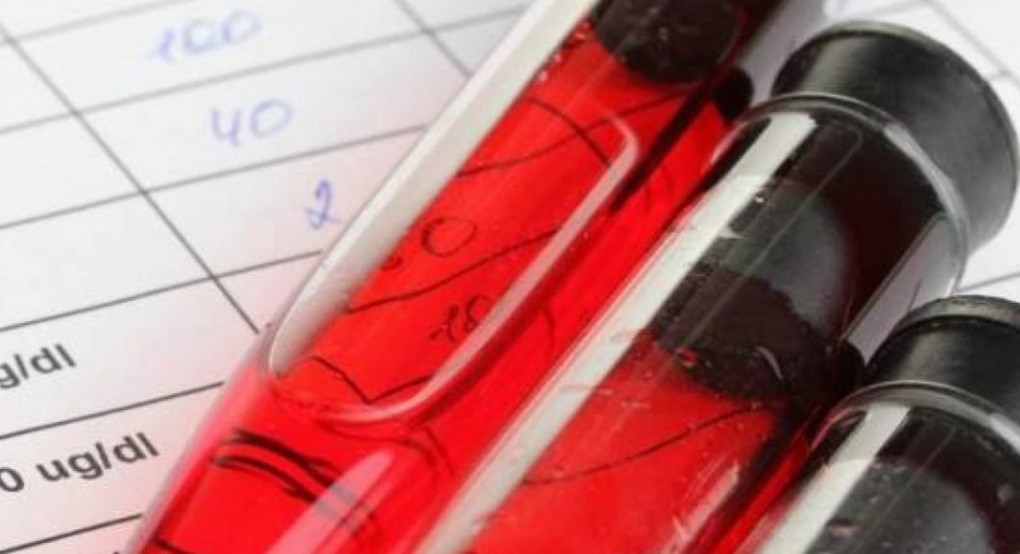 Αιματοκρίτης: Τι πρέπει να προσέχετε σε κάθε ηλικία