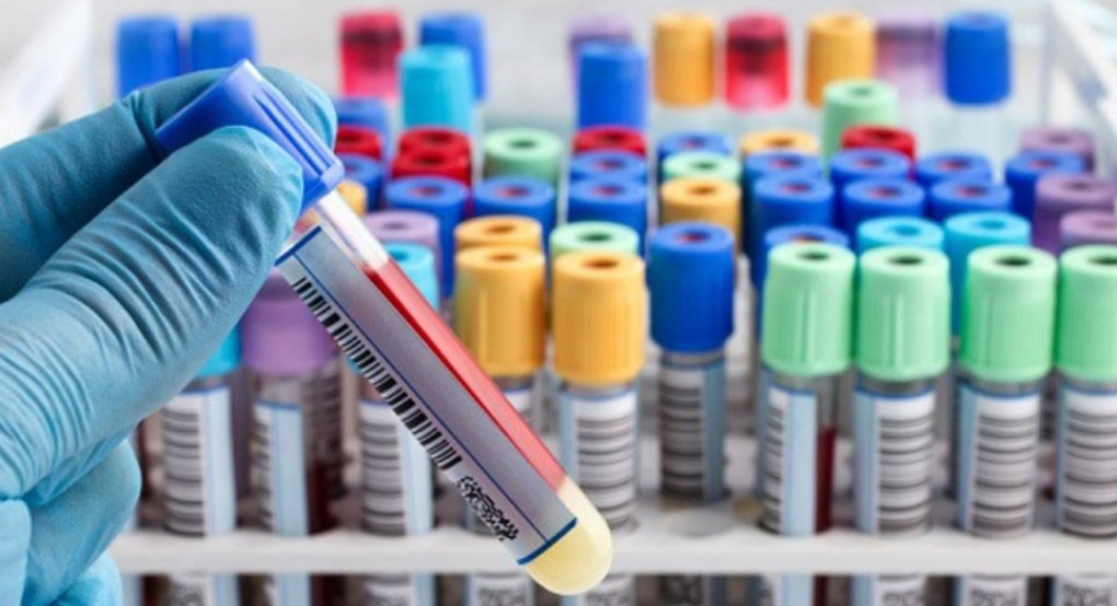 Φάρμακα για τον κορωνοϊό: Τα ενθαρρυντικά νέα από τις έρευνες και το ελληνικό «οπλοστάσιο» κατά του ιού