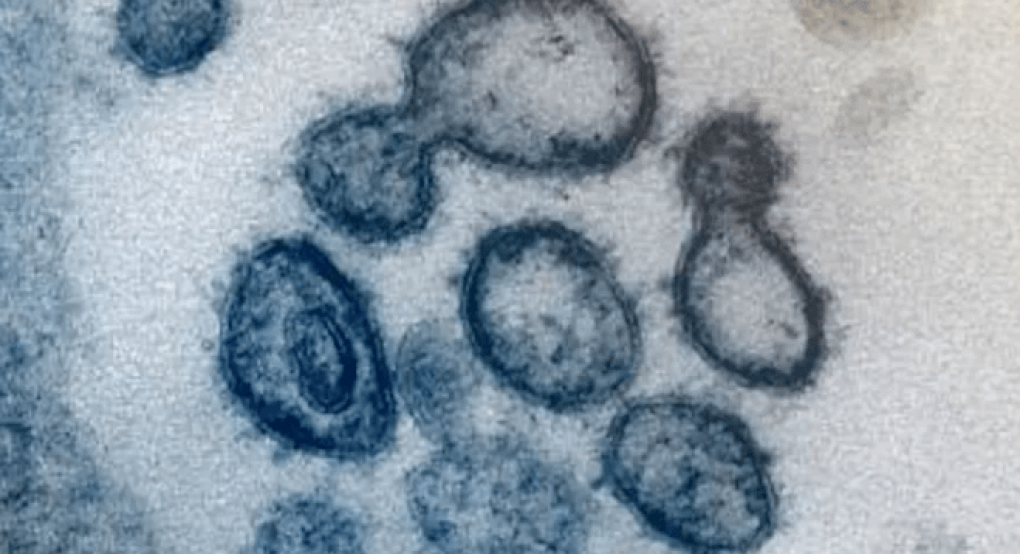 Οι πρώτες εικόνες του κορωνοϊού από το μικροσκόπιο [βίντεο & εικόνες]
