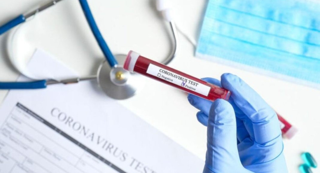 Στην Ελλάδα η πρώτη παρτίδα των ταχύτατων τεστ για τον κορωνοϊό! 