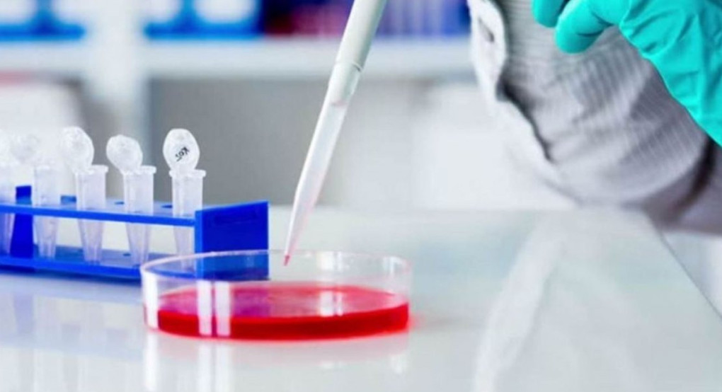 Η Ελλάδα 25η διεθνώς σε αριθμό κρουσμάτων του κορονοϊού. Κίνα, Ιταλία και Ιράν η πρώτη τριάδα