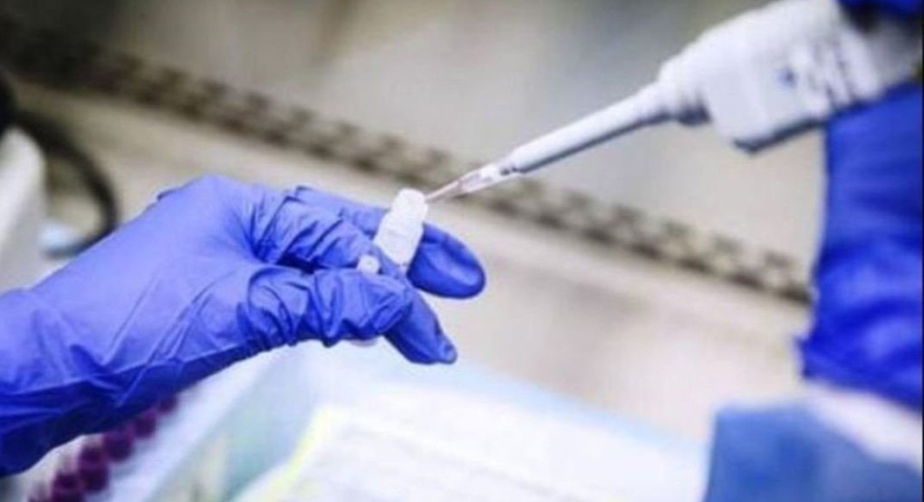 Είναι πιθανό η ασθένεια COVID-19 να γίνει εποχική, προειδοποιεί ο αμερικανός ειδικός Δρ. Άντονι Φάουτσι