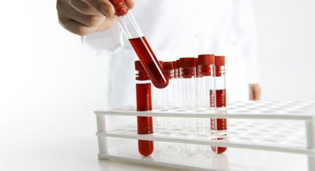 «Διατροφή και χαμηλός αιματοκρίτης»