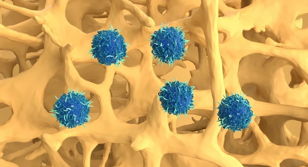 Αυτοάνοσα νοσήματα: Οι επιστήμονες δοκιμάζουν μια νέα επαναστατική θεραπεία