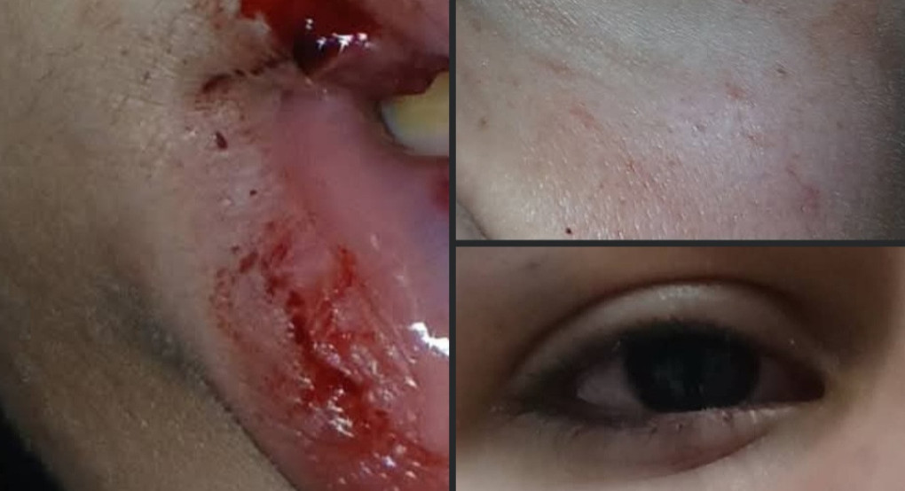 Γιαννιτσά: Καταγγελία για περιστατικό βίας ανηλίκου στον πεζόδρομο – Προβληματισμός στην τοπική κοινωνία