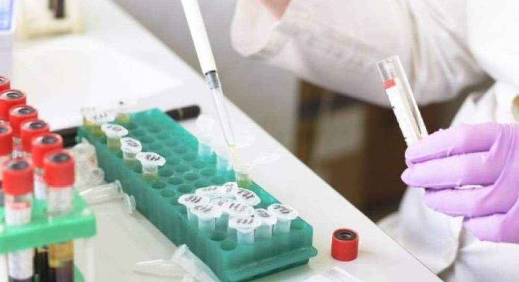 Σπουδαία ανακάλυψη – Βρέθηκε το ένζυμο που σταματά την πολλαπλασίαση του ιού