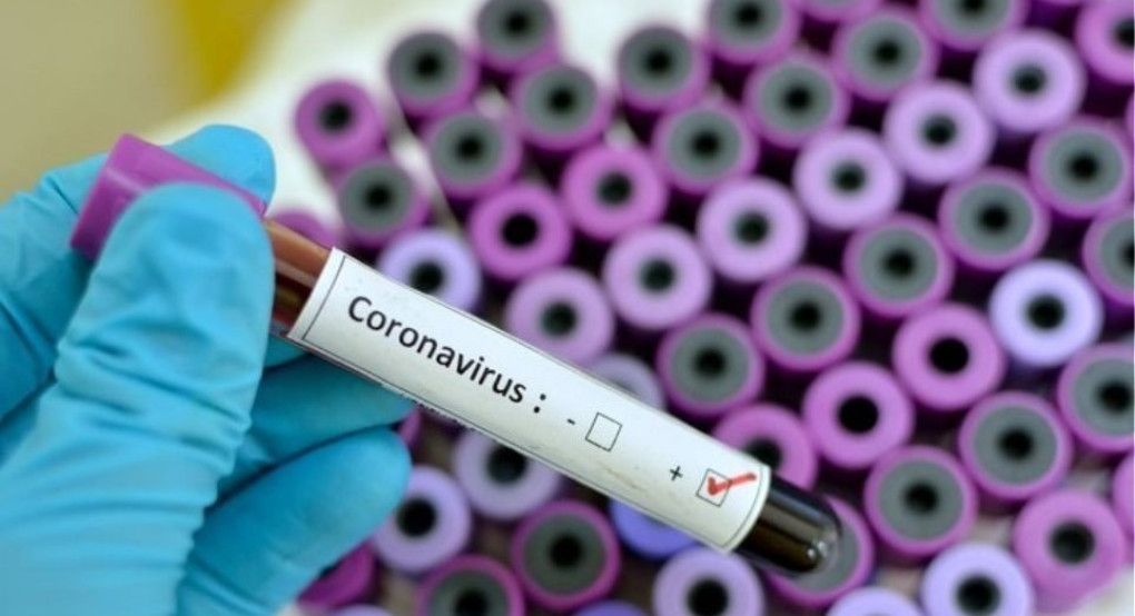 Τεστ των €45 ανιχνεύει τον κορωνοϊό σε 40 λεπτά