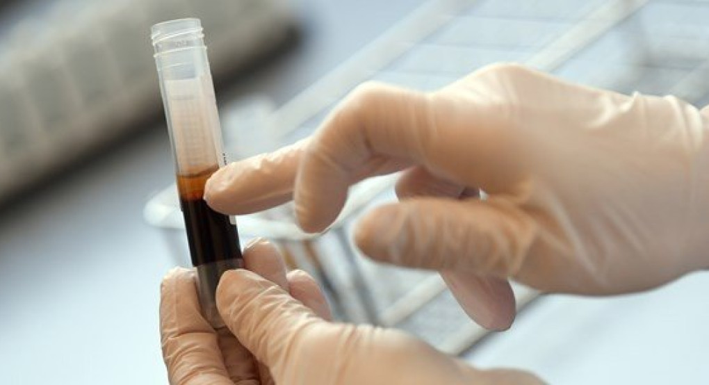 Κορονοϊός: Ξεκινά πειραματικά η χορήγηση αντισωμάτων στην Ελλάδα - Τι είπε ο Τσιόδρας