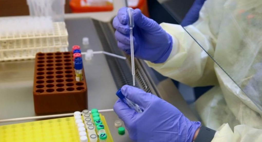 Τέλη Απριλίου αρχίζουν τα πρώτα τεστ εμβολίου για τον κορονοϊό στον άνθρωπο