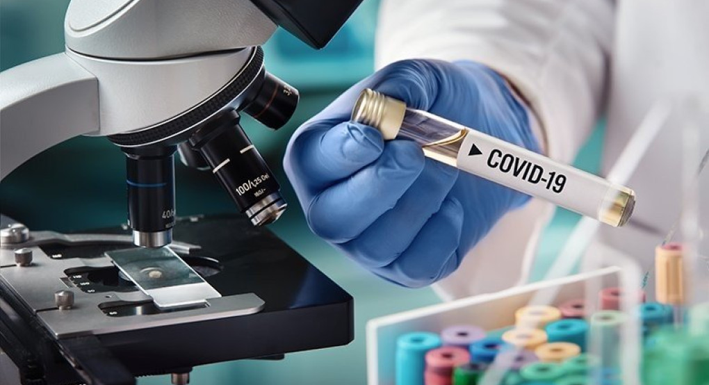 Πότε θα ξεκινήσουν τα μαζικά τεστ στον πληθυσμό