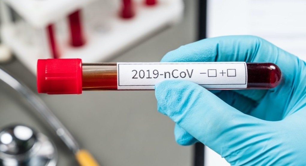 Καθηγήτρια του Πανεπιστημίου Κρήτης δηλώνει ότι είναι κοντά στο εμβόλιο -Επιστολή σε Αρναουτάκη