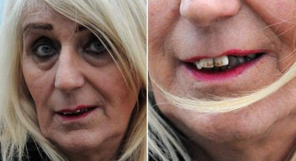 Κέρδισε 4 εκατ. στο λαχείο. Δύο μήνες μετά, δείτε πως έγινε από τις πλαστικές