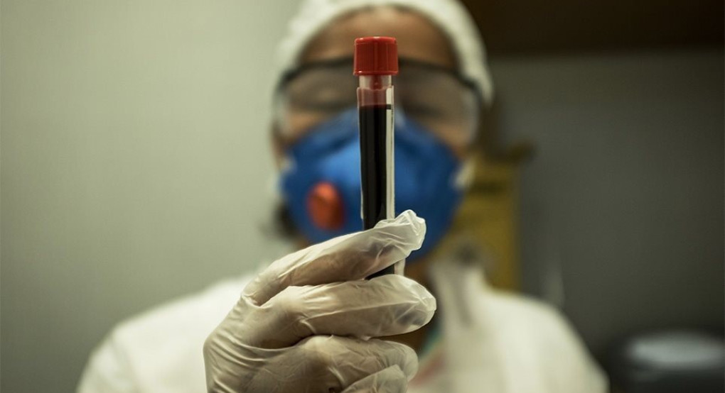 Κι όμως η φερριτίνη μας μπορεί να δείξει αν θα νοσήσουμε σοβαρά από κορωνοϊό!