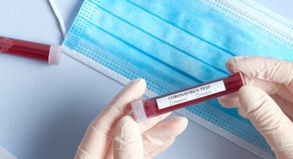 Αριθμός-ορόσημο: Αυτό είναι το όριο κρουσμάτων για την επαναφορά του lockdown στην Ελλάδα