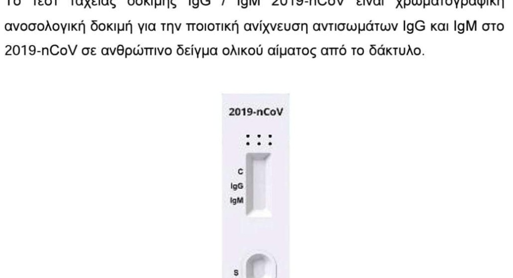 Τεστ για τον Κορωνοϊο διαθέτει ο Ιατρός Νίκος Καλαιτζογλου 