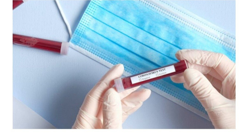 To όριο των κρουσμάτων για την επαναφορά του lockdown 