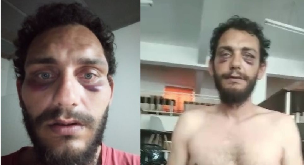 Κρητικός καταγγέλλει άγριο ξυλοδαρμό από αστυνομικούς επειδή νόμιζαν ότι είναι Πακιστανός