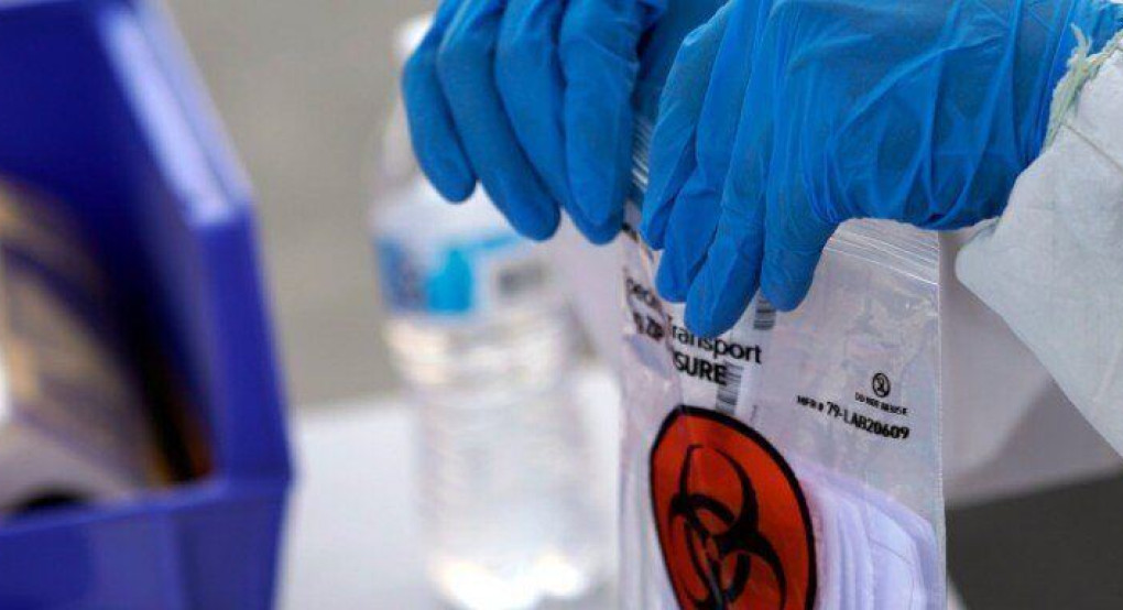 Κορωνοϊός: 30χρονος πέθανε αφού μολύνθηκε σε «πάρτι Covid»