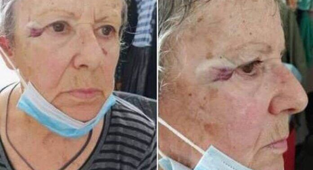 Ασύλληπτο: Ιερέας χτύπησε ηλικιωμένη επειδή τάιζε γατιά έξω από την εκκλησία