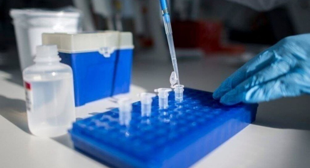 ΗΠΑ: Έγκριση τεστ που ξεχωρίζει τον Covid-19 από τη γρίπη Α και Β
