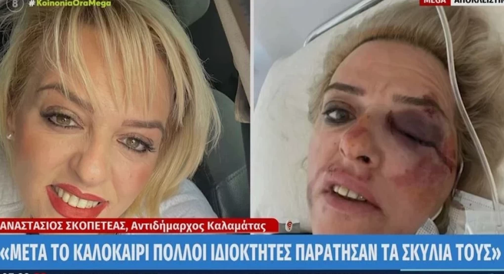 Καλαμάτα: Νέα επίθεση αδέσποτων σκύλων σε γυναίκα Καλαμάτα: Νέα επίθεση αδέσποτων σκύλων σε γυναίκα