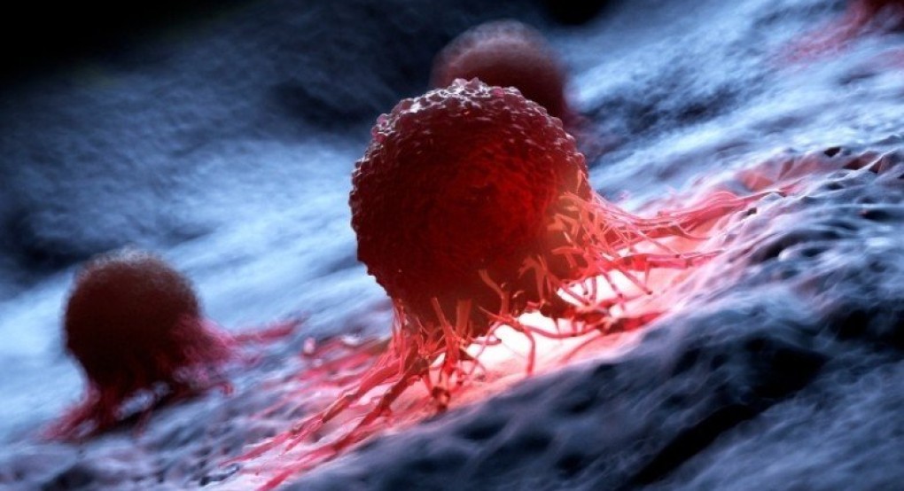 ΗΠΑ: Επιστήμονες κατάφεραν να καταστρέψουν το 99% των καρκινικών κυττάρων σε εργαστήριο