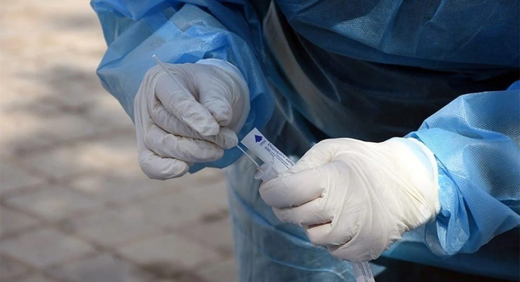 Δήμος Αλμωπίας- Ενημέρωση για διεξαγωγή rapid test Δήμος Αλμωπίας- Ενημέρωση για διεξαγωγή rapid test