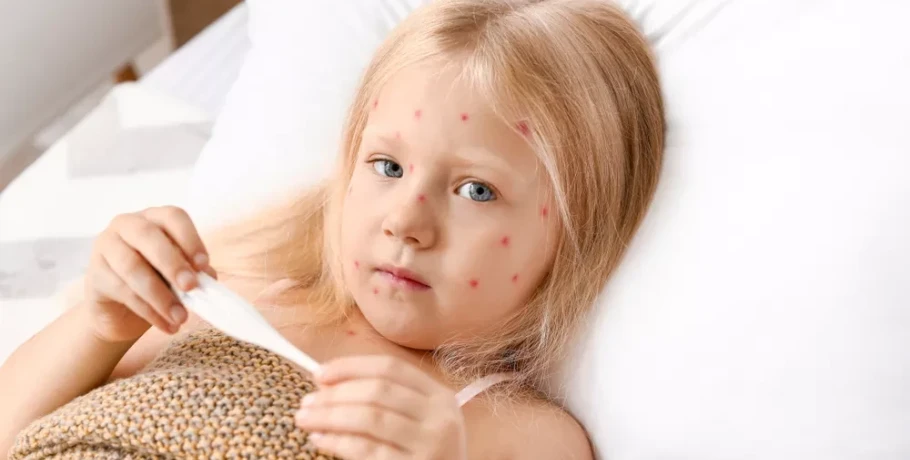 Ιλαρά και ερυθρά «επιστρέφουν» στην Ευρώπη – Η κατάσταση στην Ελλάδα