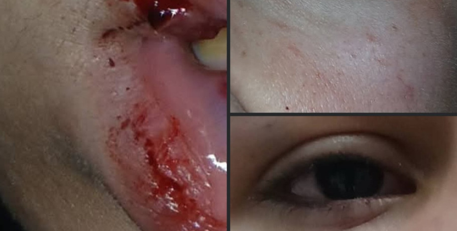 Γιαννιτσά: Καταγγελία για περιστατικό βίας ανηλίκου στον πεζόδρομο – Προβληματισμός στην τοπική κοινωνία