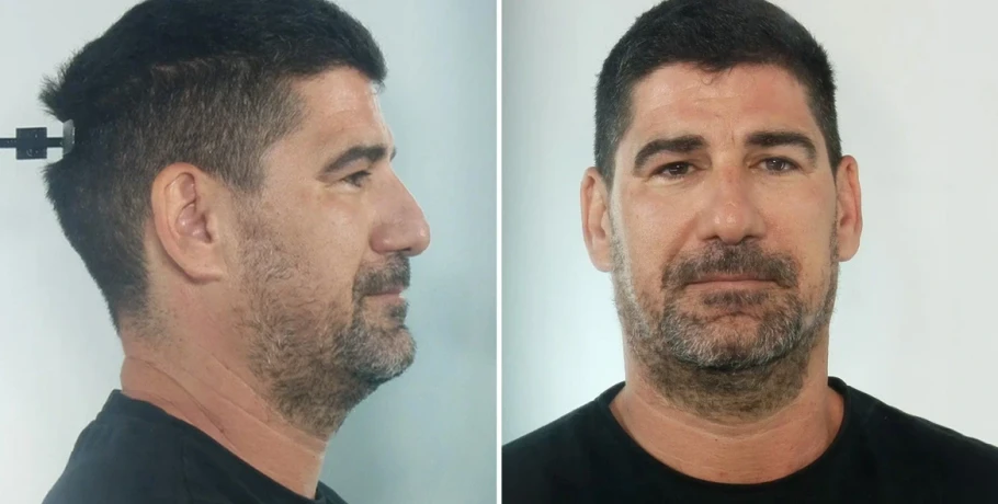 Για βιασμούς ανήλικων αθλητριών κατ’ εξακολούθηση διώκεται ο προπονητής στην Κεφαλονιά, στη δημοσιότητα τα στοιχεία του