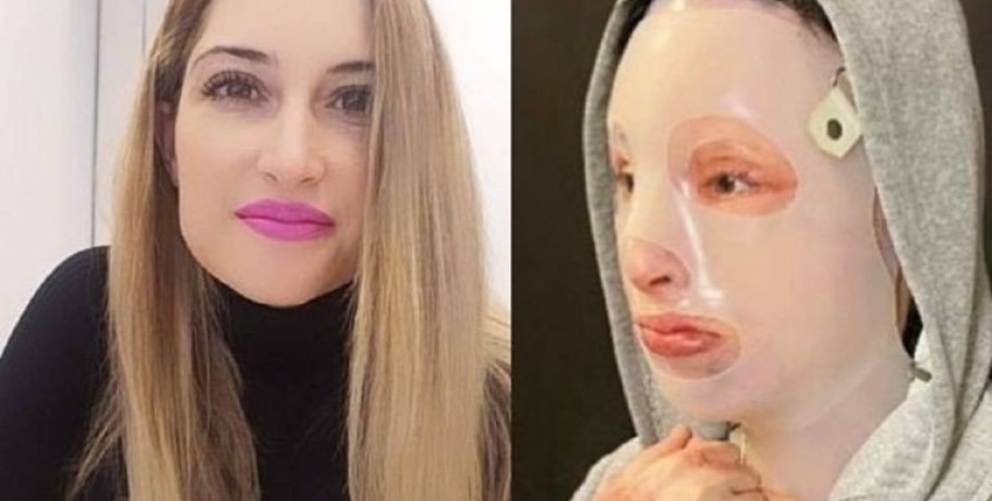 Ιωάννα Παλιοσπύρου: Πετά τη μάσκα και δείχνει το πρόσωπο της – Το πρώτο βίντεο από την κατάθεση ψυχής