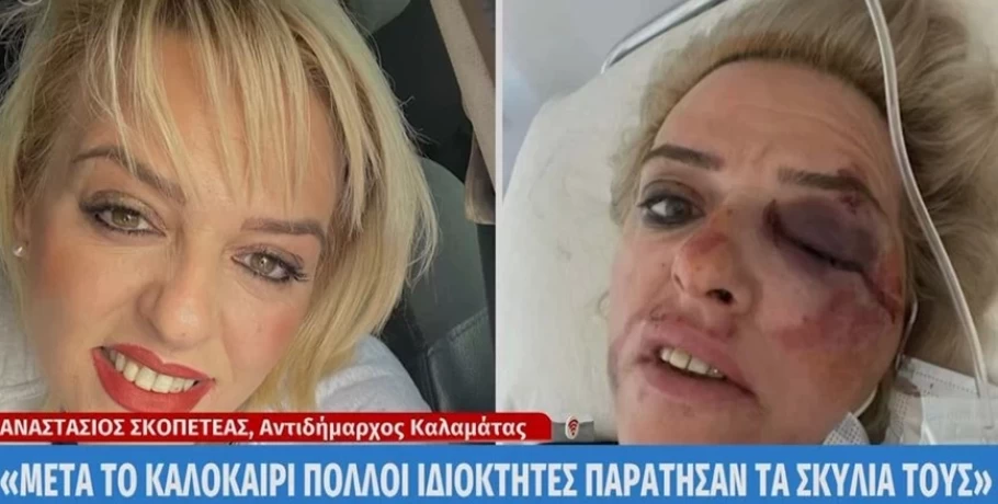 Καλαμάτα: Νέα επίθεση αδέσποτων σκύλων σε γυναίκα