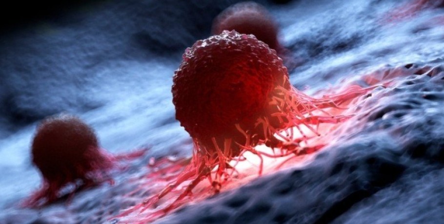 ΗΠΑ: Επιστήμονες κατάφεραν να καταστρέψουν το 99% των καρκινικών κυττάρων σε εργαστήριο