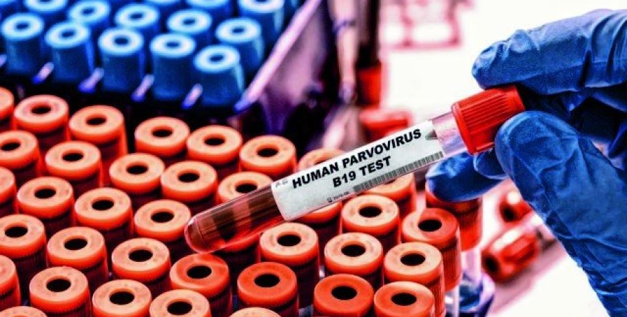 Παρβοϊός Β19: Tα συμπτώματα, η μετάδοση και τα μέτρα πρόληψης